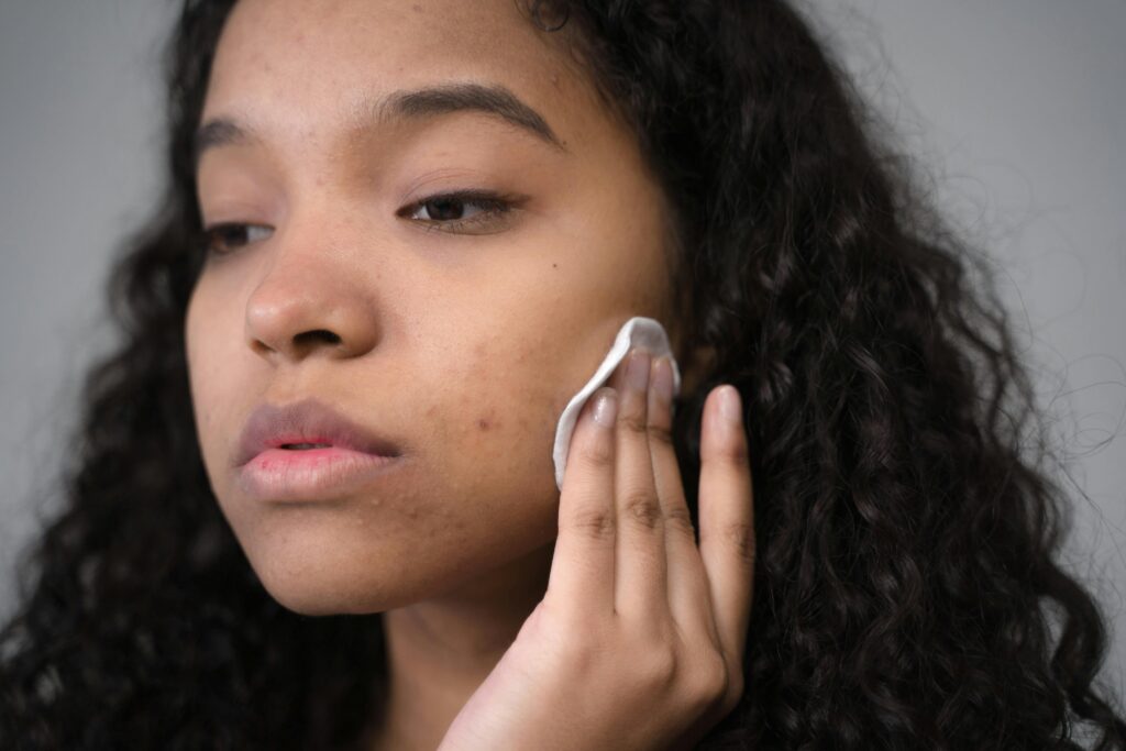 A woman with a thoughtful expression, reflecting on her skin’s journey, symbolizing self-acceptance and care.
