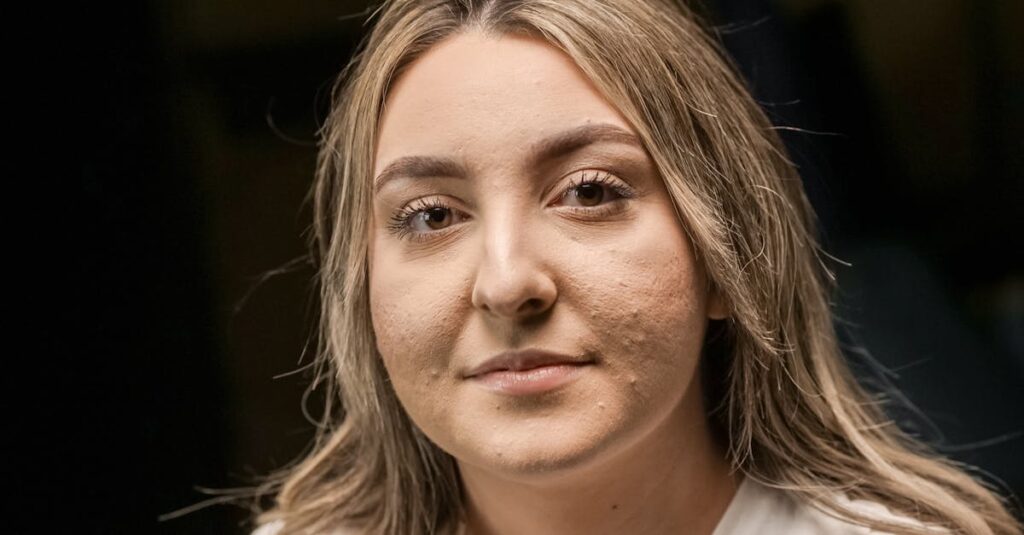 Close-up of a young woman with acne and textured skin, looking confident.