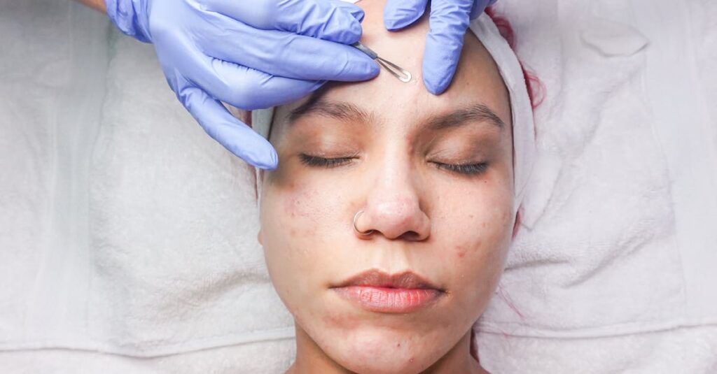 A skincare professional performing an acne extraction using a comedone extractor on a client's forehead.