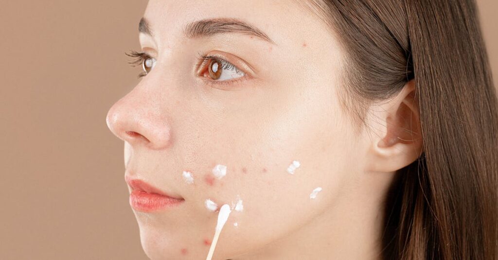 A close-up of a young woman applying natural acne remedies with a cotton swab to blemishes on her face.